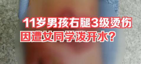 广东六岁女童被高年级同学泼开水烫伤，校园安全警示与反思